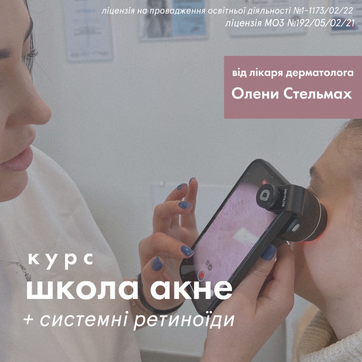 Курс "Школа акне" у Львові